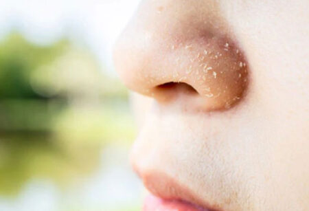 বারবার শুকিয়ে যাচ্ছে মুখ, নেপথ্যে কোন কারণ