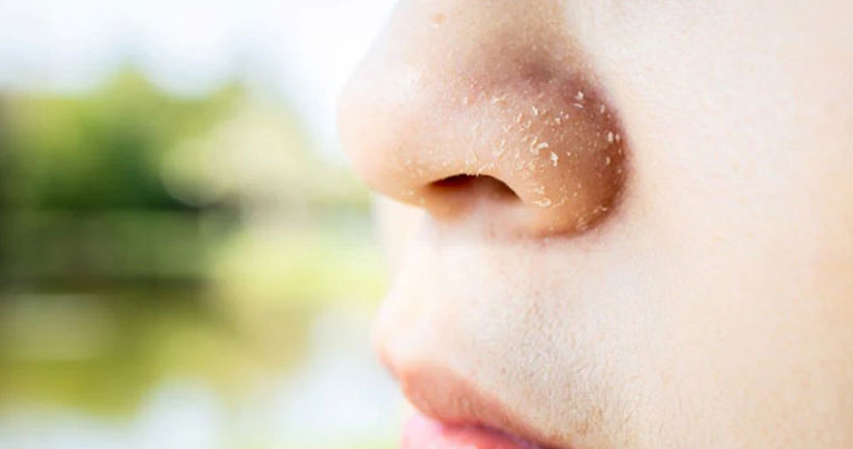 বারবার শুকিয়ে যাচ্ছে মুখ, নেপথ্যে কোন কারণ